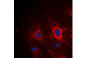 Immunofluorescent analysis of iNOS staining in A549 cells. (NOS2 Antikörper  (C-Term))