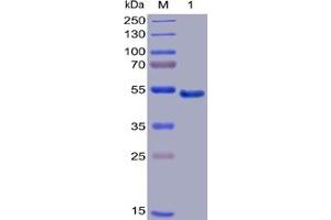 Human GITR Protein, mFc-His Tag on SDS-PAGE under reducing condition. (TNFRSF18 Protein (mFc-His Tag))