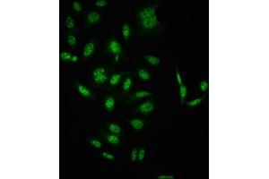 Immunofluorescence staining of HepG2 cells(treated with 50 mM Calyculin A for 30 min) with ABIN7127739 at 1:100,counter-stained with DAPI. (Rekombinanter RAF1 Antikörper  (pSer621))