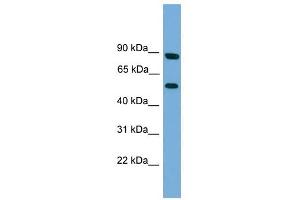 RFTN2 antibody used at 1 ug/ml to detect target protein. (RFTN2 Antikörper  (N-Term))