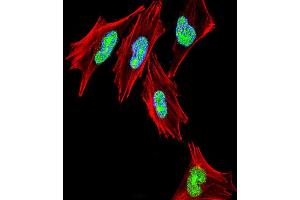 Fluorescent confocal image of  cell stained with TBX1 Antibody (C-term) (ABIN653331 and ABIN2842819). (T-Box 1 Antikörper  (C-Term))