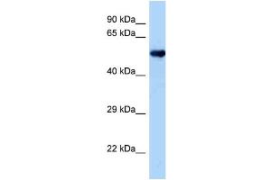 WB Suggested Anti-Oxsr1 Antibody   Titration: 1. (OXSR1 Antikörper  (Middle Region))