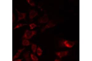 ABIN6268852 staining HeLa by IF/ICC. (GORASP2 Antikörper  (Internal Region))