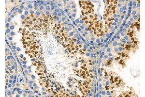 ABIN6265928 and ABIN6272456 at 1/100 staining Mouse testis tissue by IHC-P. (USP40 Antikörper  (C-Term))