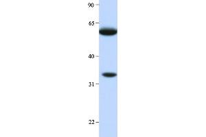 Host:  Rabbit  Target Name:  HRG  Sample Type:  Human Liver  Antibody Dilution:  1. (HRG Antikörper  (Middle Region))