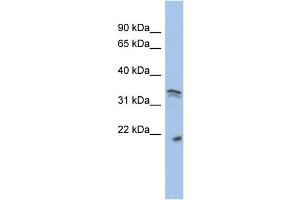 WB Suggested Anti-CDC2 Antibody Titration:  0. (CDK1 Antikörper  (Middle Region))