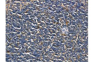 ABIN6260641 and ABIN6268823 at 1/100 staining Mouse spleen tissue by IHC-P.