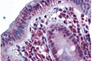Human Colon (formalin-fixed, paraffin-embedded) stained with CD180 antibody ABIN343899 at 5 ug/ml followed by biotinylated goat anti-rabbit IgG secondary antibody ABIN481713, alkaline phosphatase-streptavidin and chromogen. (CD180 Antikörper  (N-Term))
