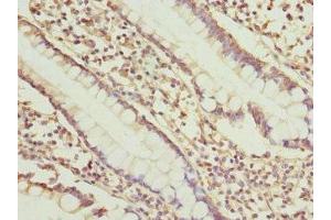 Immunohistochemistry of paraffin-embedded human small intestine tissue using ABIN7149657 at dilution of 1:100 (SGCD Antikörper  (AA 60-289))