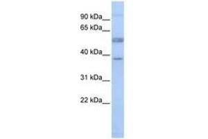 Image no. 1 for anti-Lymphocyte-Specific Protein 1 (LSP1) (AA 36-85) antibody (ABIN6741485) (LSP1 Antikörper  (AA 36-85))