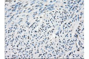 Immunohistochemistry (IHC) image for anti-Carbonic Anhydrase IX (CA9) antibody (ABIN1497095) (CA9 Antikörper)