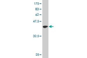 Western Blot detection against Immunogen (35. (CDK4 Antikörper  (AA 211-303))