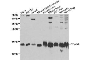 Western blot analysis of extracts of various cell lines, using COX5A Antibody. (COX5A Antikörper  (AA 1-150))
