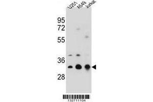 TPM4 Antibody (N-term) western blot analysis in U251,A549,Jurkat cell line lysates (35 µg/lane). (Tropomyosin 4 Antikörper  (N-Term))