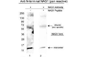 Image no. 1 for anti-Growth Differentiation Factor 15 (GDF15) (N-Term), (Variant D), (Variant H) antibody (ABIN453967) (GDF15 Antikörper  (N-Term, Variant D, Variant H))