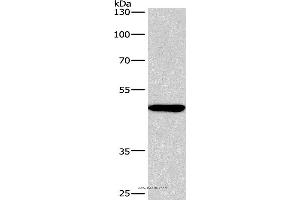 Western blot analysis of A549 cell, using BMP15 Polyclonal Antibody at dilution of 1:266. (BMP15 Antikörper)