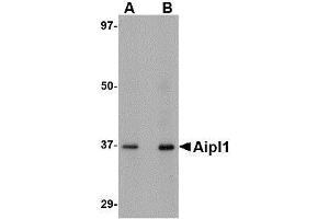 Western blot analysis of Aipl1 in human brain tissue lysate with AP30036PU-N Aipl1 antibody at (A) 1 and (B) 2 μg/ml. (AIPL1 Antikörper  (C-Term))