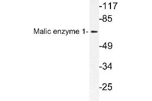 Western blot (WB) analysis of Malic enzyme 1 antibody in extracts from HeLa cells. (ME1 Antikörper)
