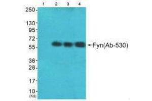 Western blot analysis of extracts from HeLa cells (Lane 2), A549 cells (Lane 3) and HepG2 cells (Lane 4), using Fyn (Ab-530) antiobdy. (FYN Antikörper  (Tyr530))
