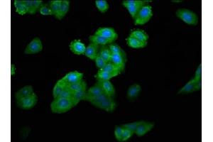 Immunofluorescence staining of HepG2 cells with ABIN7160580 at 1:100, counter-stained with DAPI. (MYH4 Antikörper  (AA 896-1045))