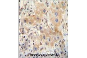 Immunohistochemistry (Paraffin-embedded Sections) (IHC (p)) image for anti-Nuclear Receptor Subfamily 0, Group B, Member 2 (NR0B2) (AA 56-83) antibody (ABIN655027)