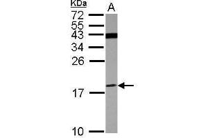 WB Image Sample (30 ug of whole cell lysate) A: U87-MG 15% SDS PAGE antibody diluted at 1:500 (ATP6V1F Antikörper)