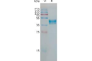 SDS-PAGE (SDS) image for Hypocretin (Orexin) Receptor 1 (HCRTR1) (AA 1-46) protein (Fc Tag) (ABIN7491309)