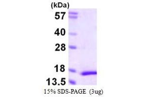 SDS-PAGE (SDS) image for Myosin, Light Chain 5, Regulatory (MYL5) (AA 1-132) protein (His tag) (ABIN667952)