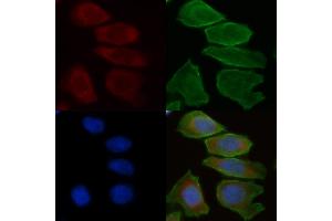 ABIN6258708 and ABIN6275305 staining Hela cells(30 min of UV treatment) by IF/ICC. (CHRNA10 Antikörper  (C-Term))