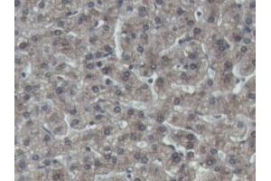DAB staining on IHC-P; Samples: Porcine Liver Tissue (IGFBP4 Antikörper  (AA 23-259))