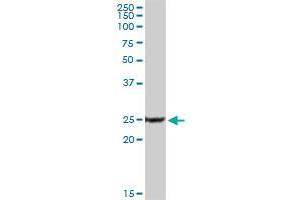 Western Blotting (WB) image for anti-Protein Phosphatase 3, Regulatory Subunit B, alpha (PPP3R1) (AA 1-170) antibody (ABIN519134)