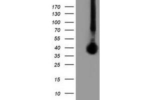 Western Blotting (WB) image for anti-Family with Sequence Similarity 84, Member B (FAM84B) antibody (ABIN1498208) (FAM84B Antikörper)