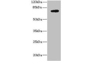 Western blot All lanes: DARS2 antibody at 10 μg/mL + MCF-7 whole cell lysate Secondary Goat polyclonal to rabbit IgG at 1/10000 dilution Predicted band size: 74 kDa Observed band size: 74 kDa