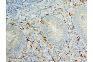 Anti-IL-8 antibody, IHC(P) IHC(P): Human Appendicitis Tissue (IL-8 Antikörper  (C-Term))