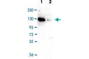 Western Blot (Cell lysate) analysis of (1) Negative control, and (2) 40 ug whole cell extracts of HeLa cells transfected with CTCF siRNA.