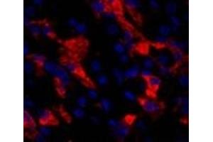 Immunofluorescence analysis of Human stomach tissue using CD284 Polyclonal Antibody at dilution of 1:200. (TLR4 Antikörper)