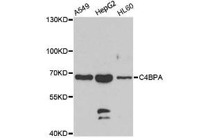 Western blot analysis of extracts of various cell lines, using C4BPA antibody. (C4BPA Antikörper  (C-Term))