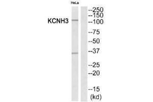 Western blot analysis of extracts from HeLa cells, using KCNH3 antibody. (KCNH3 Antikörper)