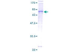 Image no. 2 for zeta-Chain (TCR) Associated Protein Kinase 70kDa (ZAP70) (AA 1-493) protein (GST tag) (ABIN1325570)