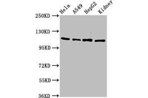 Western Blot Positive WB detected in: Hela whole cell lysate, A549 whole cell lysate, HepG2 whole cell lysate, Rat kidney tissue All lanes: NFATC3 antibody at 4. (NFATC3 Antikörper  (AA 887-1070))