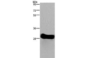 Western Blot analysis of Mouse heart tissue using FHL2 Polyclonal Antibody at dilution of 1:1900 (FHL2 Antikörper)