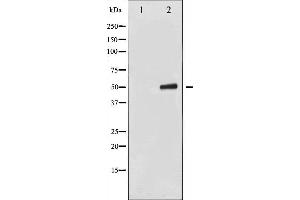 Western Blotting (WB) image for anti-Keratin 8 (KRT8) (pSer432) antibody (ABIN6255334)