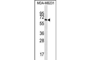 GBP1 Antibody (N-term) (ABIN656423 and ABIN2845715) western blot analysis in MDA-M cell line lysates (35 μg/lane).