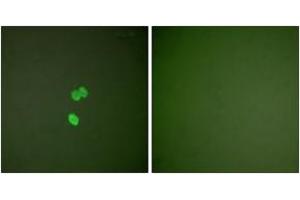 Immunofluorescence analysis of NIH-3T3 cells, using Galectin 3 Antibody. (Galectin 3 Antikörper  (AA 141-190))