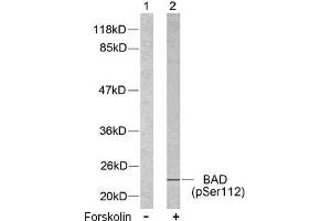 Image no. 2 for anti-BCL2-Associated Agonist of Cell Death (BAD) (pSer112), (pSer75) antibody (ABIN196734) (BAD Antikörper  (pSer75, pSer112))