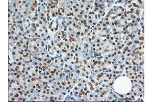 Immunohistochemical staining of paraffin-embedded Human Kidney tissue using anti-TACC3 mouse monoclonal antibody. (TACC3 Antikörper)