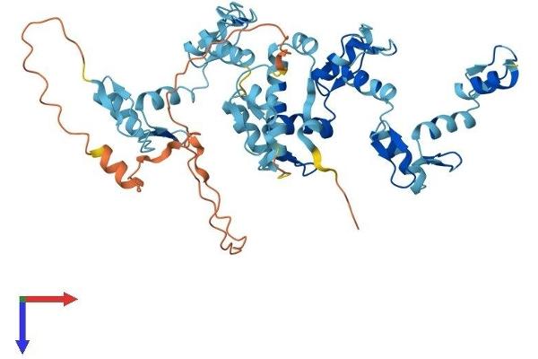 ZIM3 Protein (AA 1-472) (His tag)