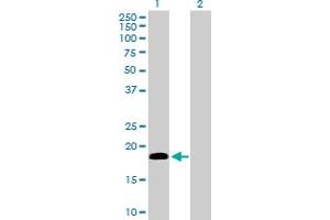 Western Blot analysis of CETN1 expression in transfected 293T cell line by CETN1 MaxPab polyclonal antibody. (Centrin 1 Antikörper  (AA 1-172))