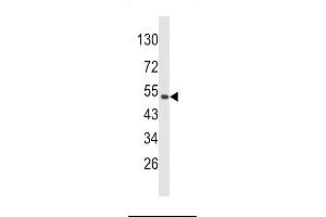 PLEKHO1 Antikörper  (N-Term)