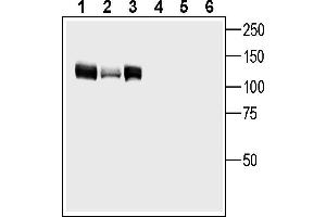 Western blot analysis of human  prostate adenocarcinoma cell line lysate (lanes 1 and 4), human  MG glioblastoma cell line lysate (lanes 2 and 5) and human  ovarian carcinoma cell line lysate (lanes 3 and 6):1-3. (GPR158 Antikörper  (Intracellular))